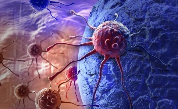 肿瘤患者|家有肿瘤患者,要如何饮食有三大饮食原则及注意要点要记住