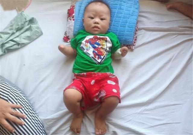 怀孕|多次产检医生都说正常,孩子出生后,孕妇哭泣医生傻眼,娃太可怜