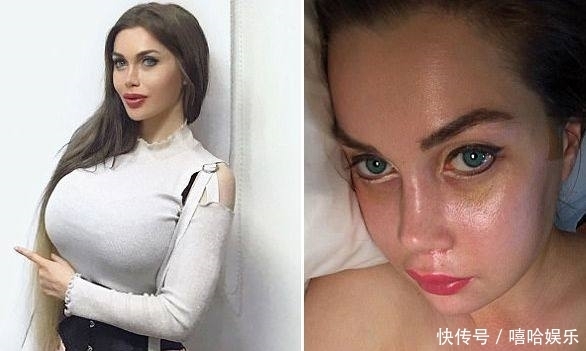 整形手术|美国一女子去韩国做危险极高的额骨手术，还说整容上瘾