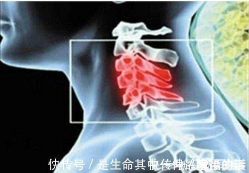 头晕|颈椎安康:得了颈椎病不要怕,四个防护方法助您保护您的颈椎