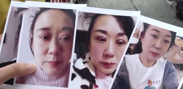 江西|江西一女子花2万割双眼皮，术后美容院“很满意”，女子：你是不是瞎?
