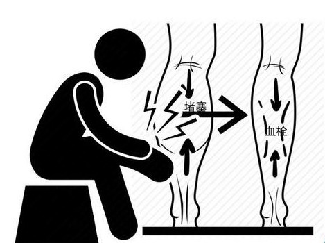 血管|血脂高不高腿先知道,腿部出现4种状况,可能是血脂超标要重视