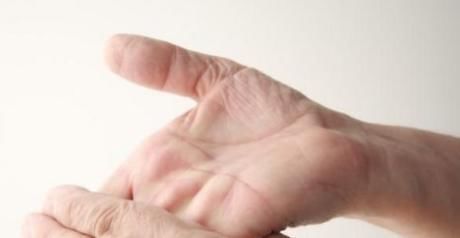疾病|经常手麻脚麻,是“中风”的前兆吗?小心3种疾病,早知早受益