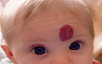 饮食习惯|怀孕期间要注意的几个事项, 否则宝宝会长胎记, 尤其是第2个