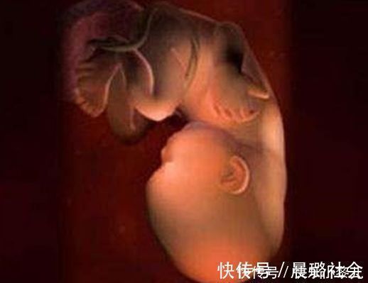b超检查|怀胎9个月，胎儿长什么样？宝宝4斤会不会有点偏小？