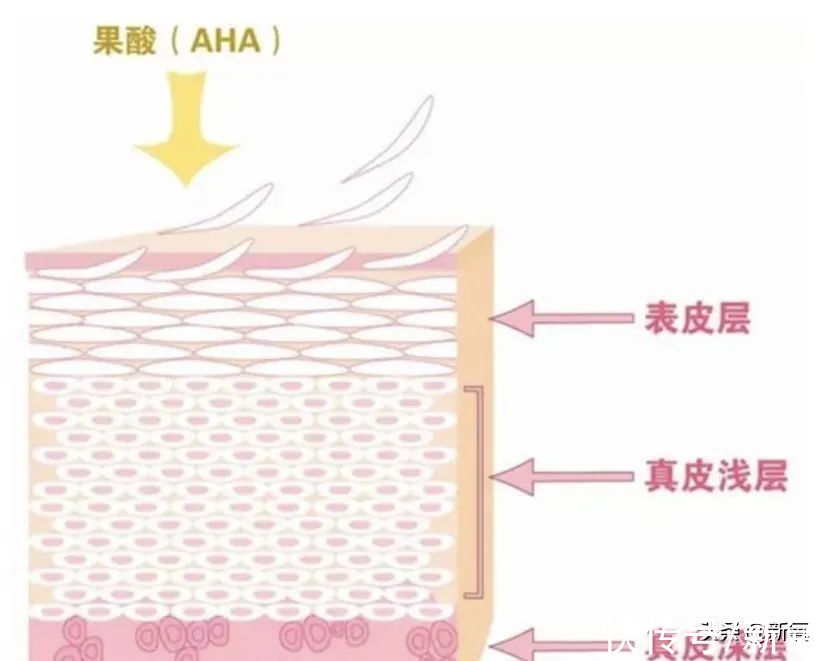 脂肪粒|她鼻背两旁的小疙瘩，到底是啥？