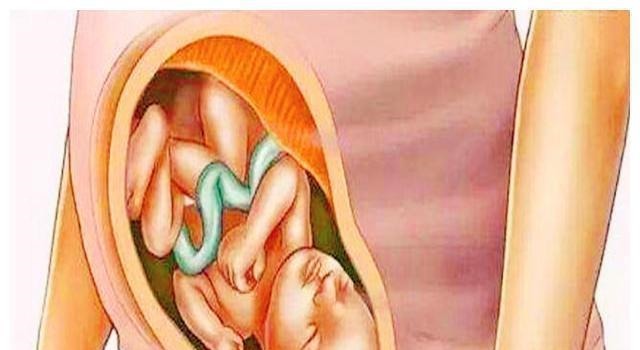 暴涨期|胎儿在宫内是如何发育成型的?十张图读懂胎儿发育过程,都该看看