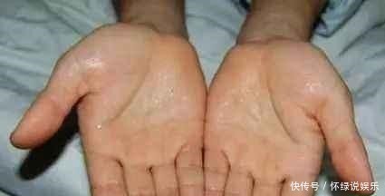 夏天|无论男女,汗从哪里来,病也跟着来,夏天爱出汗的人,别太晚看到