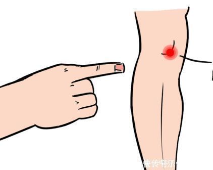 膝盖|夫妻双双手术换掉膝盖!罪魁祸首竟是坚持10年的“好习惯”!