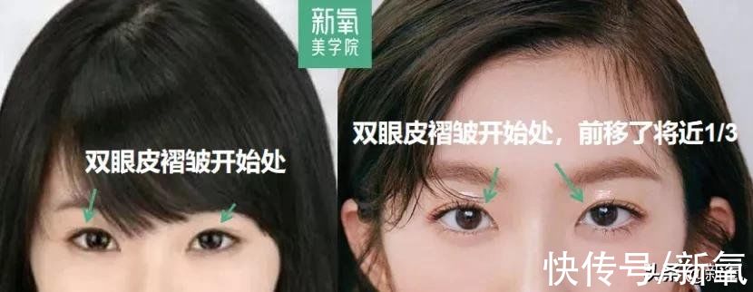 眼距&很多人都混淆了眯眯眼和小眼睛的区别