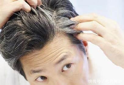 白头发可以拔吗?怎样能变回黑发?中医教你正确的白头发预防之道