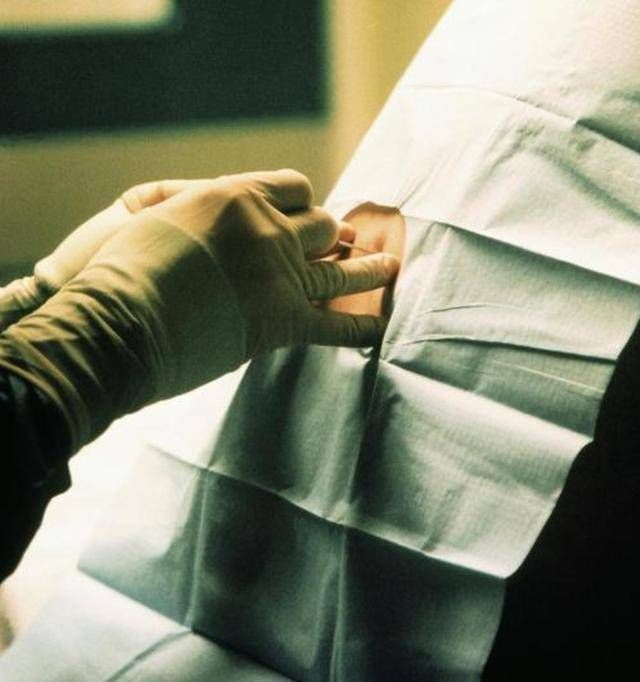 腰椎针|剖腹产就是打一针睡一觉看看这根腰椎针的长度，还仅仅是个开头