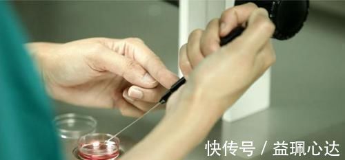 输卵管|国内首例试管婴儿已31岁，现状让不少人失望了，有些事不得不提