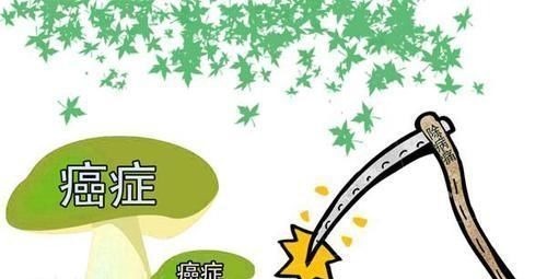 胰腺癌|查出癌症晚期，还有没有必要治疗答案很直白，别不接受