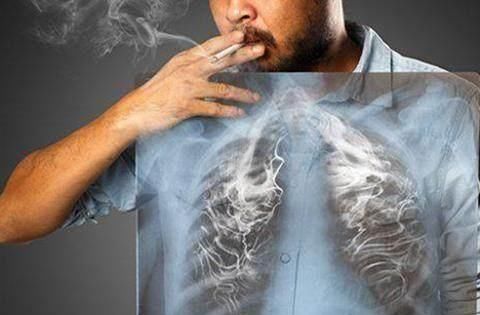  毛病|为什么有的老人一直抽烟，身体却没毛病？医生：这3个习惯帮了忙
