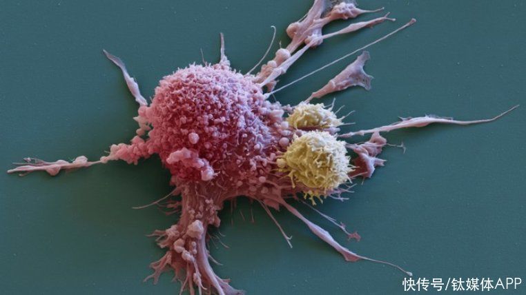 文章|网上1/3的癌症治疗文章都是谣言，但却比真相更受人关注