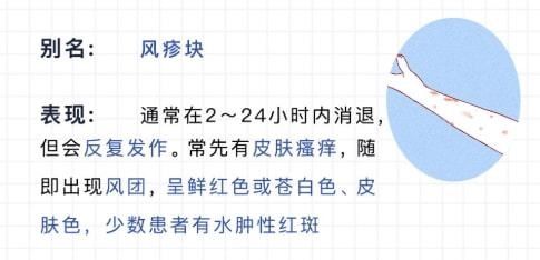 红血丝|不停打嗝、眼睛出现红血丝......这些小毛病其实非常危险