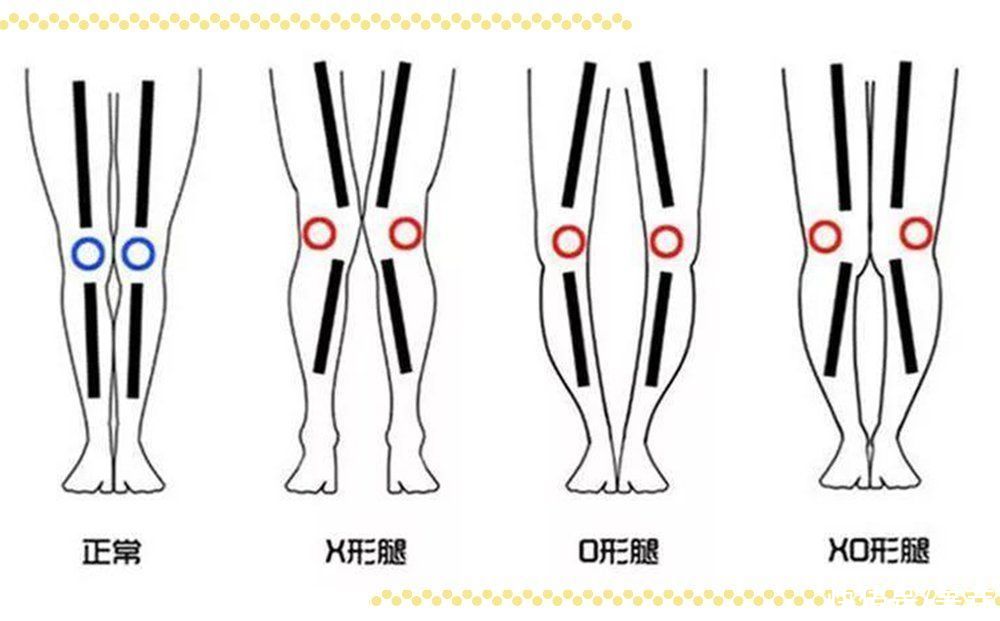 服了！到底什么样的腿才能算美腿啊