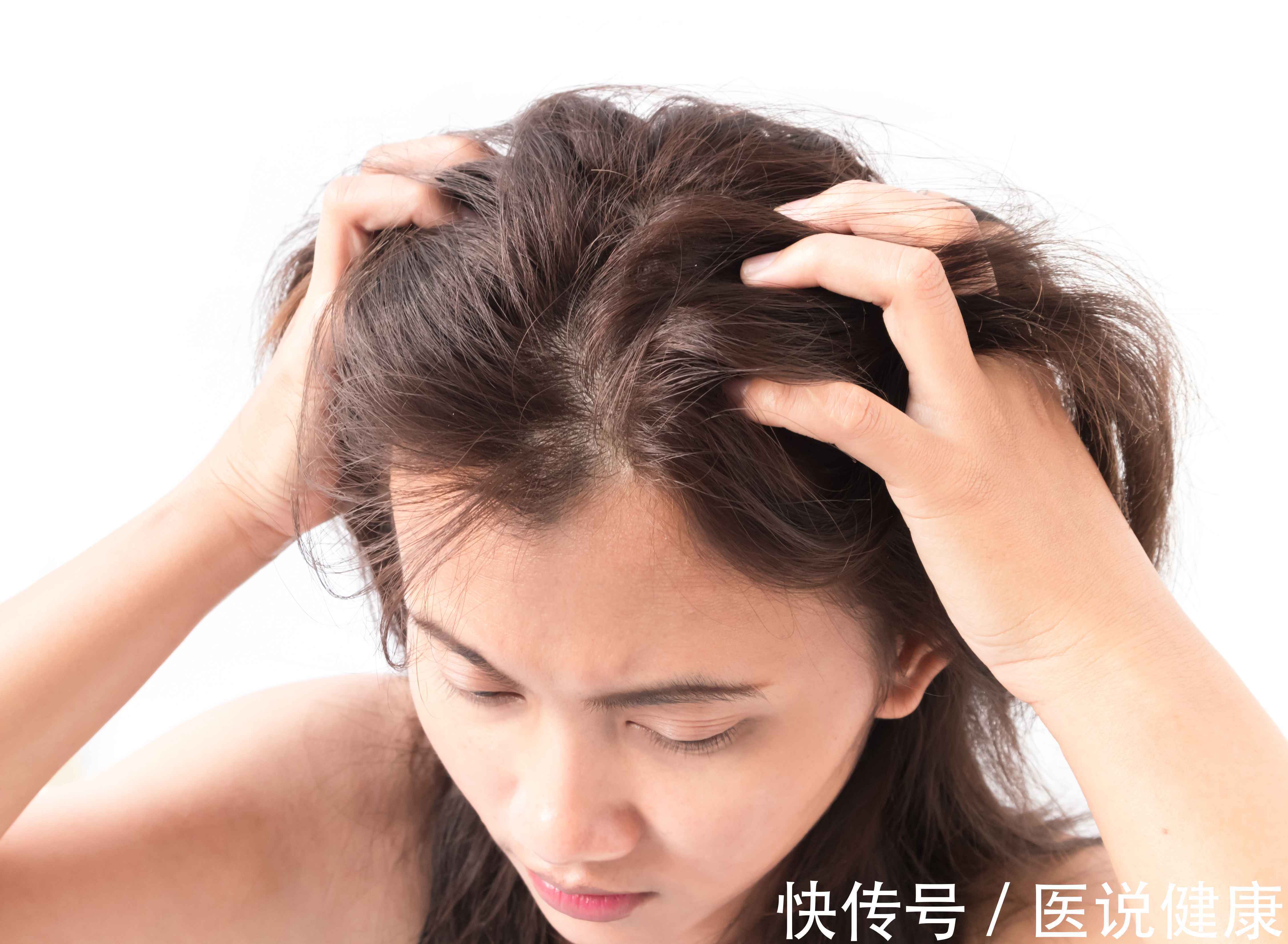 毛囊|说好的长发及腰,提前却秃了头?让人狂掉发的3件事,劝你要谨慎