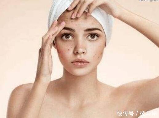 如果你有3个护肤习惯，那么痘印离你只有一步之遥！请小心