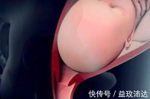 分娩|产房分娩的过程是啥?实拍图还原顺产过程,看完明白为母则刚