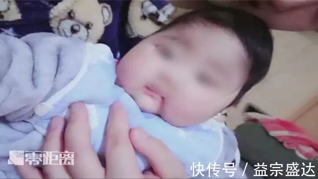 迟缓|八个月宝宝发育迟缓，罪魁祸首竟是一款宝宝霜！专家：家长需警惕