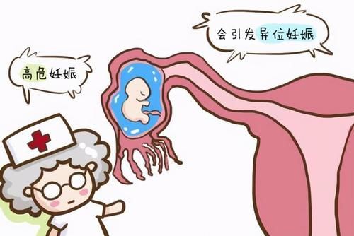 危害|过期妊娠危害究竟有多大？准妈妈们一定要注意，可别傻傻不知道