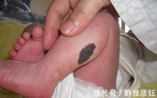 理论|发现新生儿小屁屁上有“淤青”，老公想找护士理论，最后暗暗庆幸