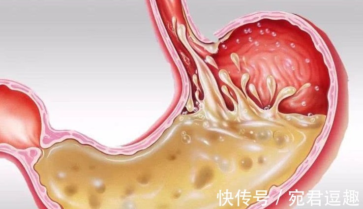 女孩儿|把50cm“仙女管”塞入胃里的女孩儿，是自虐上瘾吗？