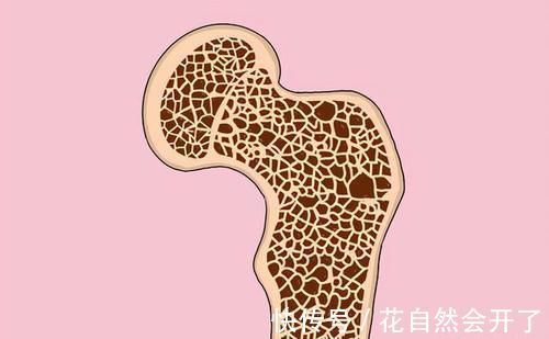 女性|50岁左右的女性，手经常痛，是什么原因？骨科医生给您解释下