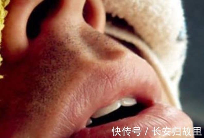 真相|女子晚上睡覺，嘴里跑出十幾條蟲子，到醫院檢查真相大白