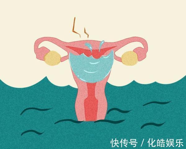 妇科疾病|5个症状是宫颈炎的“信号”!做好这4项预防,让宫颈炎无计可施