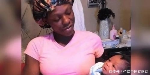 胎记|双胞胎姐姐在腹中被“吸收”,化为胎记留在弟弟腿上,令人动容