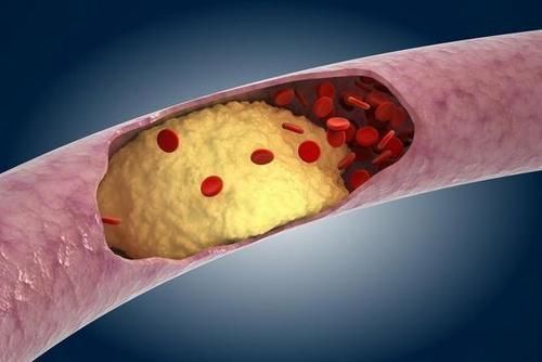 蔬菜|血脂偏高的人,吃苹果有影响吗?提醒:三类食物尽量少吃