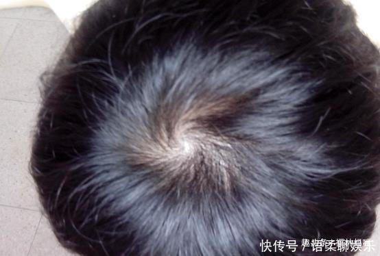 “双顶男孩找不到，双顶女孩没人要”，孩子头上的“旋”代表了啥