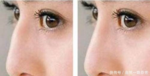 女生有这3种鼻型,皮肤再好颜值都不高!尤其第2种,很像猪鼻子!