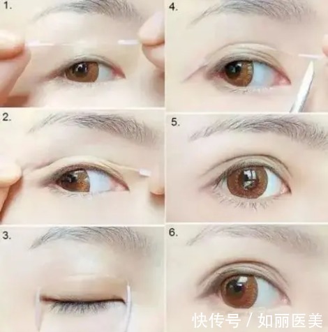 切口 割双眼皮谨记这4点护理事项!术后多久能画眼影?