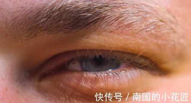 糖尿病|身体出现4大“症状”，多半是糖尿病的前兆，很多人却不在意