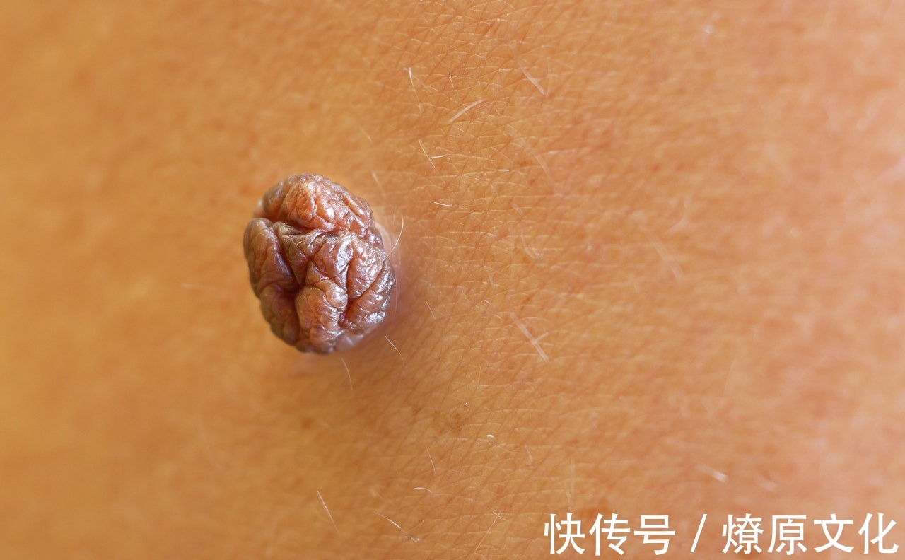 对症治疗|6种症状别“硬抗”,超过一定时间不愈可能是癌,建议及时就医