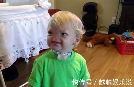 爸爸|小女孩生下来就没有鼻子,爸爸曾想抛弃孩子,妈妈的话让宝爸泪目