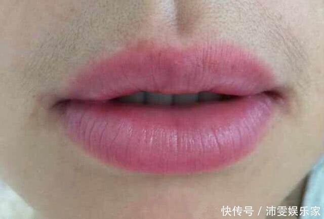 皱纹|女性开始衰老，有3处变长，1处变圆，若一个不占，说明还年轻