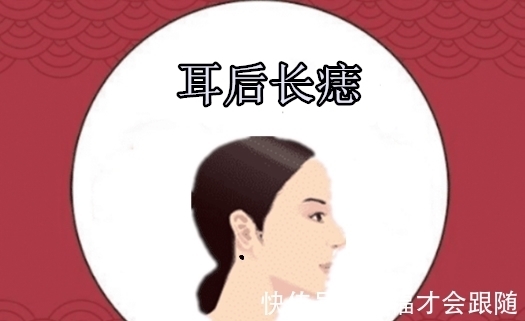 皇帝|“百里挑一的5颗痣”，男带贵，女显富，天生皇帝命，儿女双全！