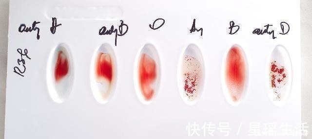 o型血|孕妇是这个血型,你和孩子都有福气,但第一胎尽量别打掉