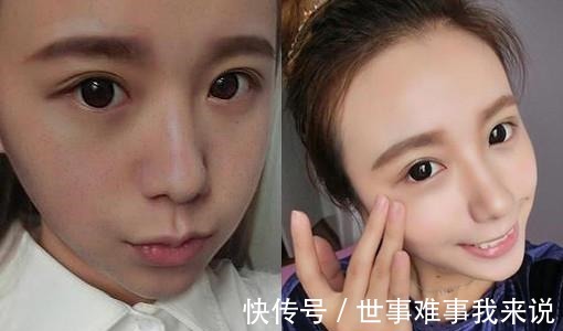 光子嫩肤 光子嫩肤这么选!效果好还省钱!光子嫩肤这么选!效果好还省钱!