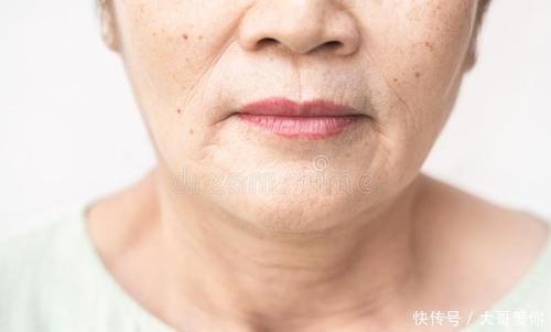  堪称|医生直言：冰箱里1种食物，堪称皮肤“灾星”，再喜欢也要扔掉