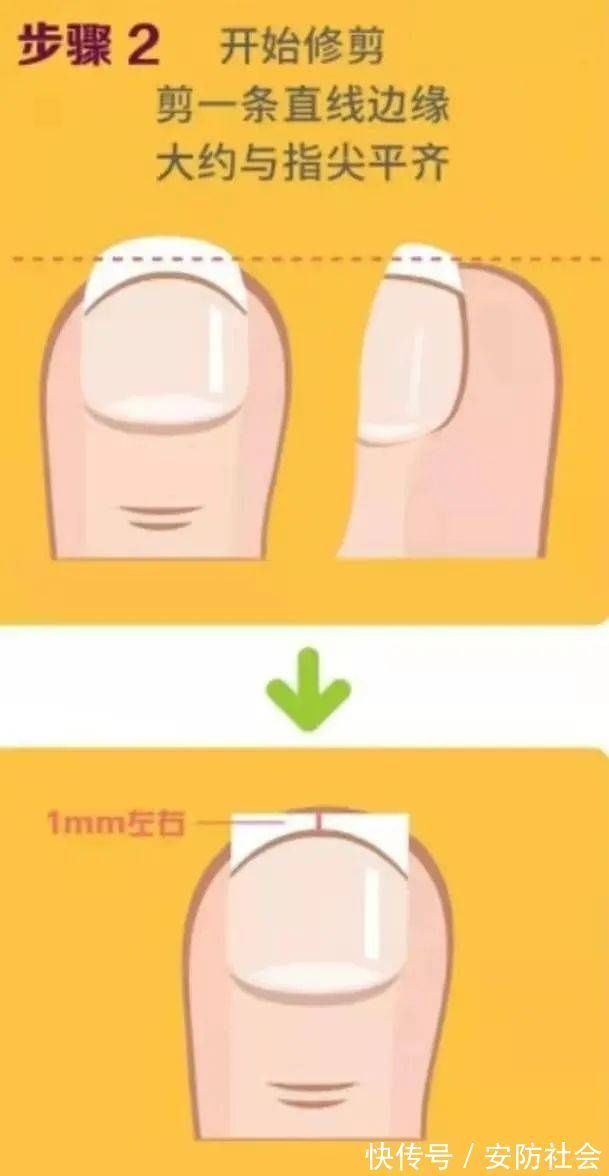 指甲缝|指甲剪不对带来大麻烦,这才是剪指甲的正确方法!