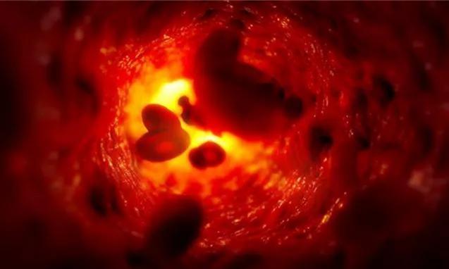 香菇根|木耳配上这四物，清血管效果更好！活血健脑强免疫，胜过一堆补药