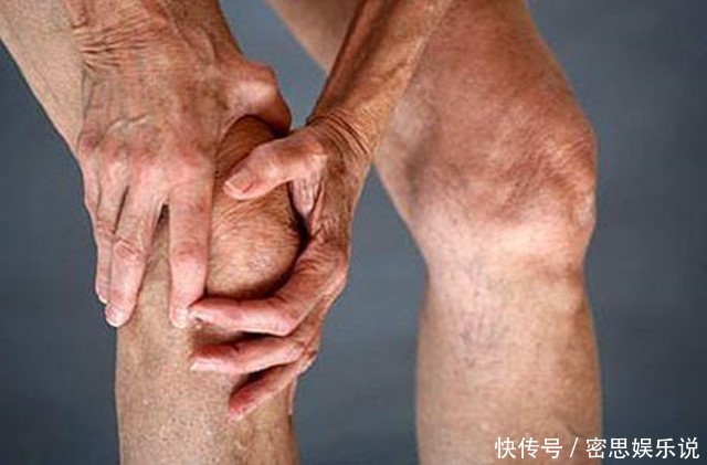 腰腿|七年之病，求三年之艾！1把艾草4味藥，這樣做，改善失眠、腰腿痛