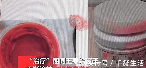 秘方|父母嫌医药费贵求助江湖医生,用秘方给幼童治烫伤致其感染身亡