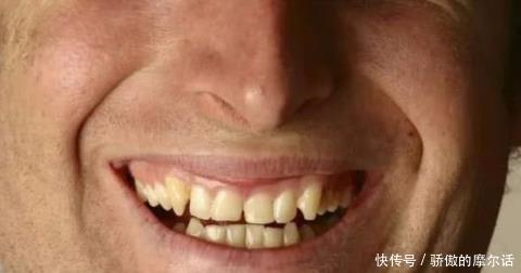 男性开始衰老时,一般有6个表现,若1个不占恭喜你,易长寿